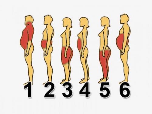 6 типов ожирения, и как справиться с каждым из них