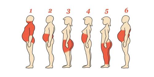 6 типов ожирения, как справиться с каждым из них 1 ожирение переедания. 6 ТИПОВ ОЖИРЕНИЯ. КАК СПРАВИТЬСЯ С КАЖДЫМ ИЗ НИХ