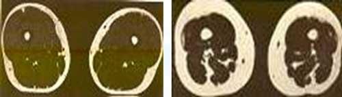 Сколько калорий тратится при ходьбе пешком. От чего зависит расход калорий 01 Сколько калорий тратится при ходьбе пешком. От чего зависит расход калорий 01