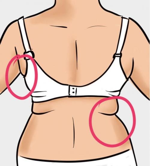 Как убрать складки на спине под лопатками. Кожные складки на спине: Причины образования и упражнения для похудения спины и боков