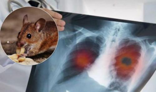 Что известно о новом вирусе. Хантавирус в Китае в 2020 году и что это такое