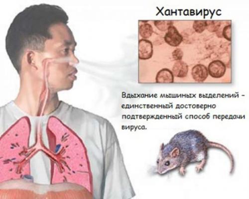 Что известно о новом вирусе. Хантавирус в Китае в 2020 году и что это такое