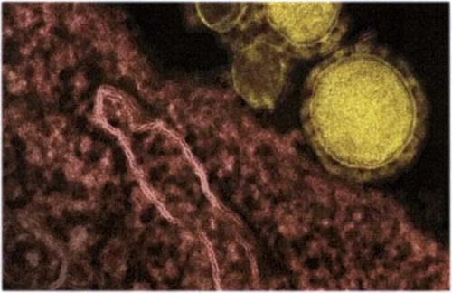Средства защиты от коронавируса. Какие лекарства нужно иметь дома для защиты от коронавируса 02