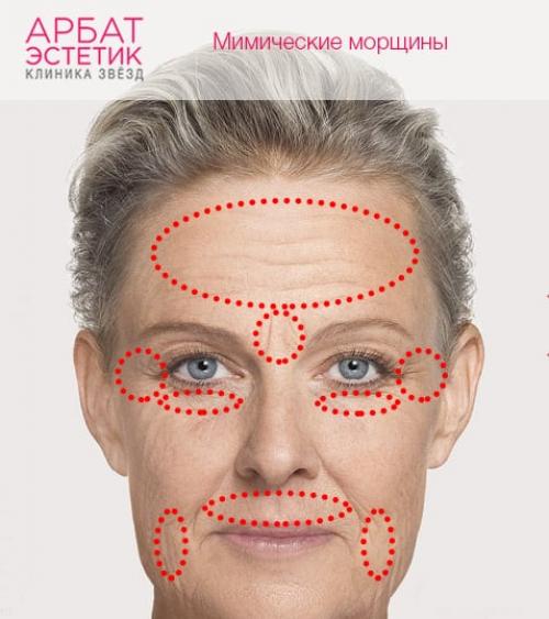 Вся правда о морщинах и методах борьбы с ними. Классификация морщин 01