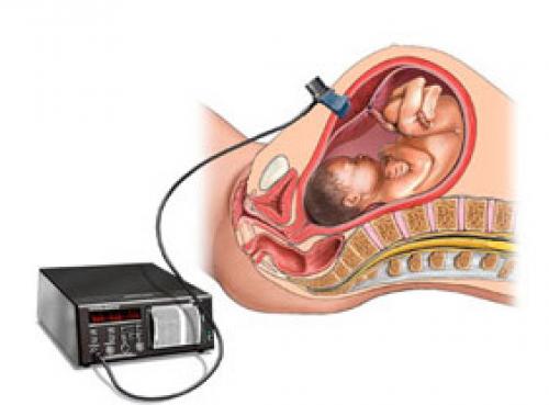 Какой должен быть пульс после физической нагрузки. Пульс и возраст
