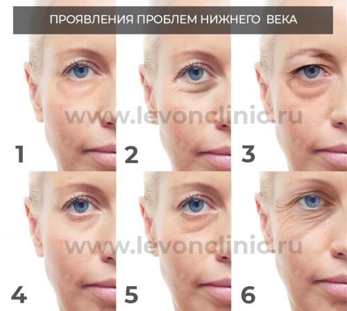 Лучшие липолитики для похудения. Насколько эффективны липолитики. Показания и противопоказания 03