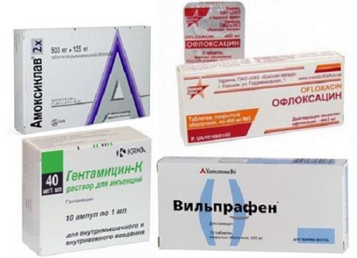 Хронический простатит, что делать. Хронический простатит: симптомы, причины 03 Хронический простатит, что делать. Хронический простатит: симптомы, причины 03