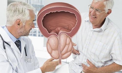 Диета при аденоме простаты. Правильно питаться (отказаться от простых углеводов) 05