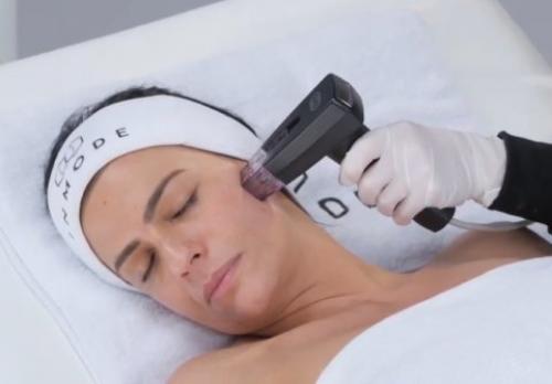 RF-лифтинг лица и тела цена от 4500 руб.. Принцип действия RF-термолифтинга 09