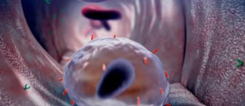 Слабые сосуды симптомы. «Транспортный коллапс»: причины и следствия