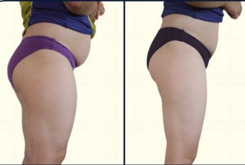 Сколько кг можно скинуть за месяц на голоде. Каких результатов можно добиться при 30 дневном голодании