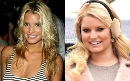 За сколько времени можно похудеть на 20-30 кг. За 2-3 месяца 04