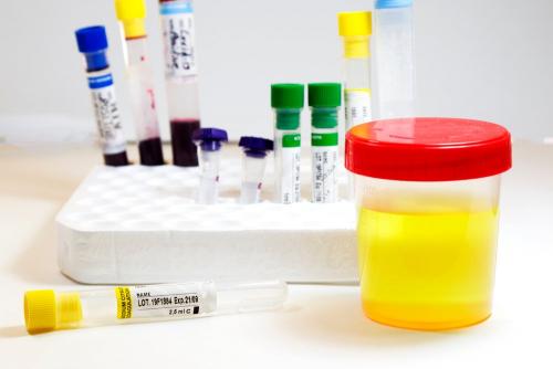 Как правильно сдавать мочу на анализ. Общий анализ мочи: как правильно его сдавать? 03