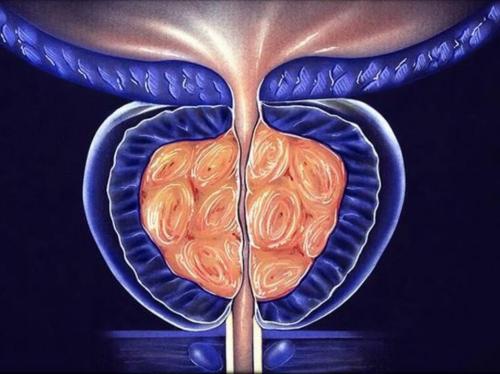Топ-5 эффективных лекарств для лечения простатита. Схема лечения простатита при помощи лекарств 01