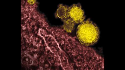 Пять загадочных путей, по которым мог появиться коронавирус 07 Пять загадочных путей, по которым мог появиться коронавирус 07