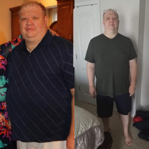 Чем лишний вес отличается от ожирения. Диагностика лишнего веса и ожирения 08 Чем лишний вес отличается от ожирения. Диагностика лишнего веса и ожирения 08