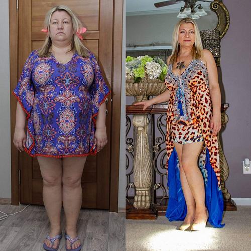 Чем лишний вес отличается от ожирения. Диагностика лишнего веса и ожирения 07 Чем лишний вес отличается от ожирения. Диагностика лишнего веса и ожирения 07